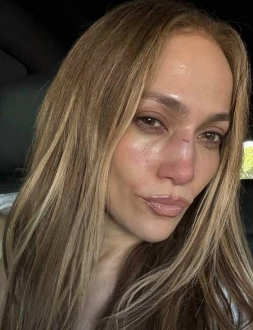 55-Летняя дженнифер лопес получила тяжелую травму лица во время репетиции.  