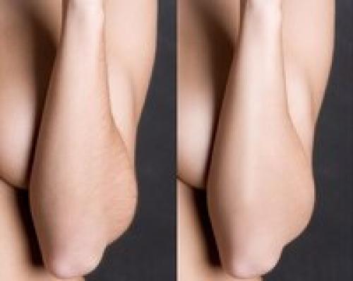 Админ, опубликуй пожалуйста анонимно. 05