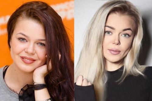 Алина гросу несколько пластических операций сделала. 02