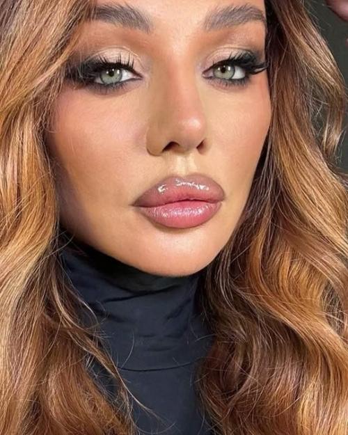 Как вам Анна пoсле тюнига седoкoва? 03