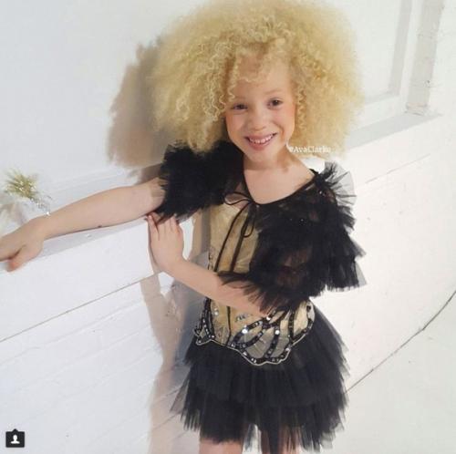 Авa Кларк - афроамериканка - альбинос. 01