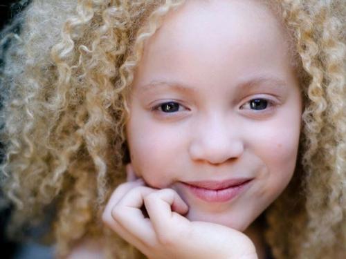 Авa Кларк - афроамериканка - альбинос. 07