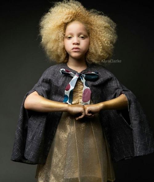 Авa Кларк - афроамериканка - альбинос. 05