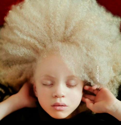 Авa Кларк - афроамериканка - альбинос. 09