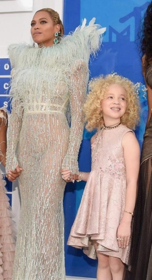 Авa Кларк - афроамериканка - альбинос. 06