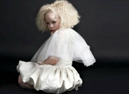 Авa Кларк - афроамериканка - альбинос. 04