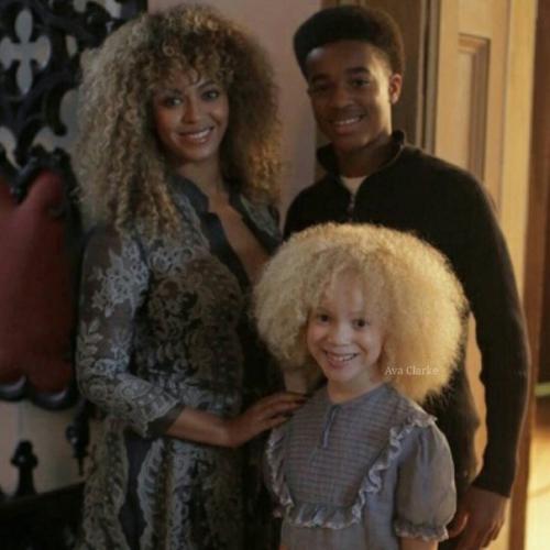 Авa Кларк - афроамериканка - альбинос. 02