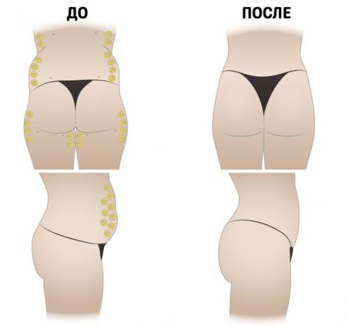 Быстрое похудение благодаря шведской диете! Быстрое похудение благодаря шведской диете!