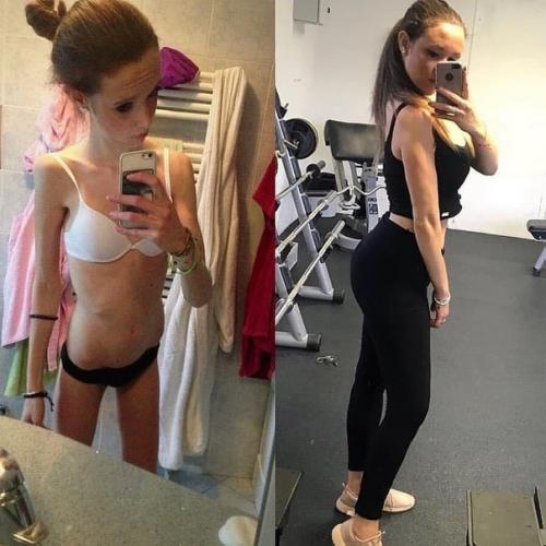 Я думаю, анорексия - это такое же страшное заболевание как и ожирение. 01