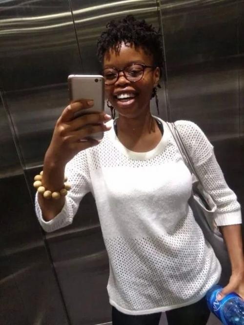 Южноафриканка сенетисив гининдза с 15 лет страдает от редкого заболевания - гигантомастии. 03