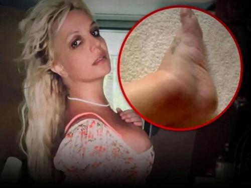 У Бритни Спирс проблемы со здоровьем, поклонники обеспокоены её состоянием. 02