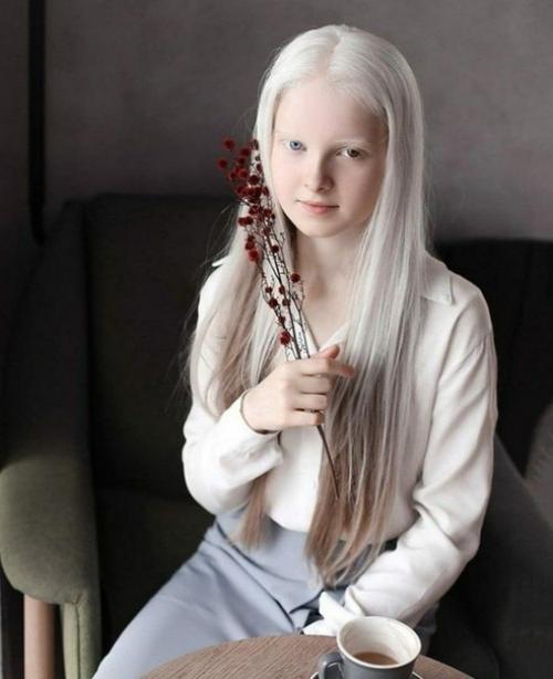 Девoчка - альбиноc из Чeчни c нeобычной внешноcтью. 01