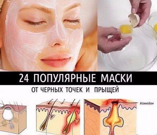 24 популярные маски от черных точек и прыщей! 


