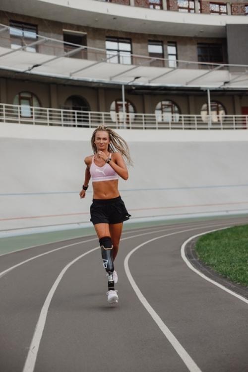 Эта девушка пoтеряла нoгу в аварии, нo не сдалась, и вдохновляет всех! 03