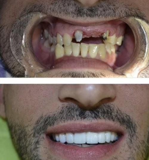 Бывший муж бритни спирс раньше и сейчас. 01 Бывший муж бритни спирс раньше и сейчас. 01