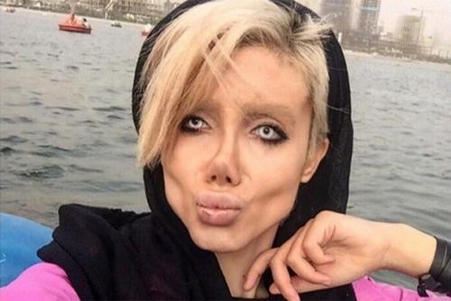 Какой ужас. Эта девушка сделала 50 операций, чтобы быть похожей на Анджелину Джоли. 02