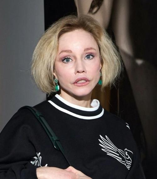 Марина зудина сделала неудачную пластику? 02