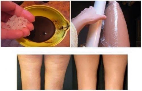 Курс из 5 обертываний убирает несколько сантиметров с талии и бедер!