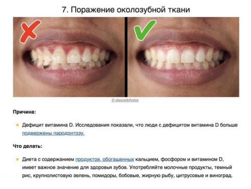 8 сигналов тела, которые помогают понять, каких витаминов не хватает вашему организму. 06