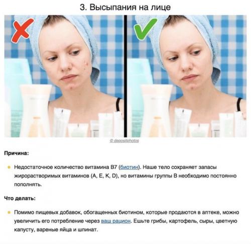 8 сигналов тела, которые помогают понять, каких витаминов не хватает вашему организму. 02