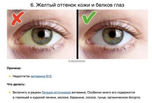 8 сигналов тела, которые помогают понять, каких витаминов не хватает вашему организму. 05
