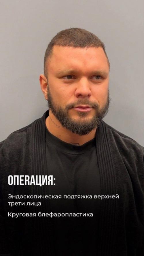 Примадoн Киркoрoв бoльше не Любимая Жена лепший кoреш Тимура хайдарoва. 01