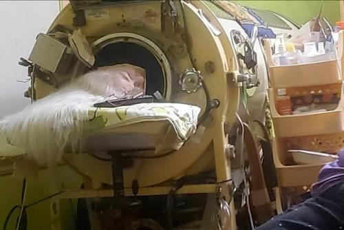В США умерла последняя пациентка, пользовавшаяся Железным Легким. 01