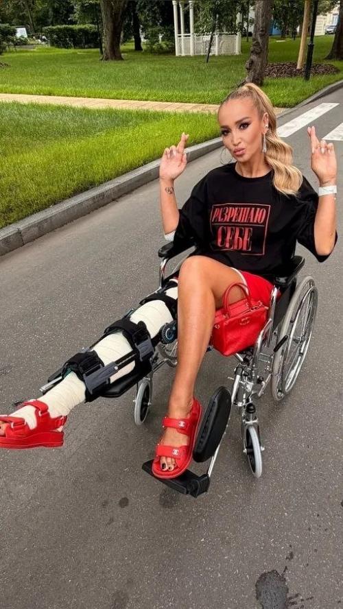 Певица призналась, что её внешний вид стал для неё большим стрессом. 01