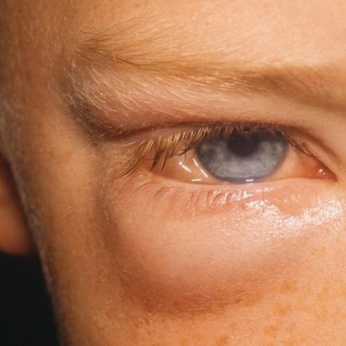 Сделайте репост пожалуйста, все должны знать!