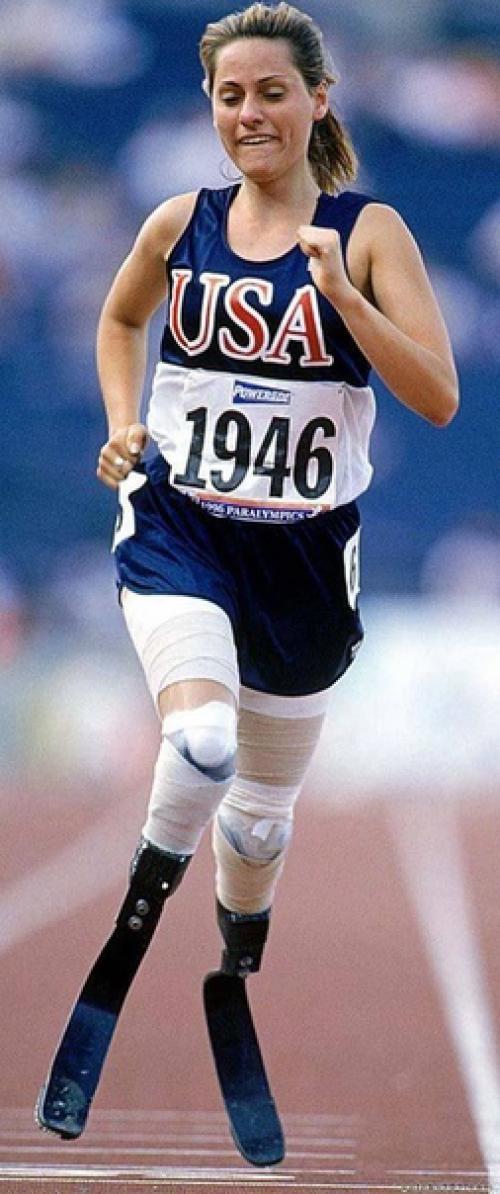 39-Летняя американка Эйми маллинз - живой символ успеха для людей с ограниченными возможностями. 04