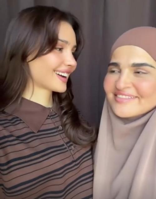 Блогер Дина саева маму до и после пластической операции показала. 02