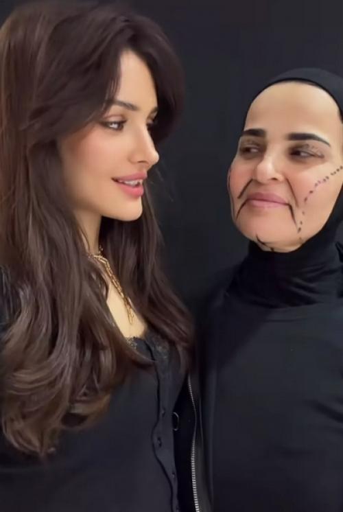 Блогер Дина саева маму до и после пластической операции показала. 01