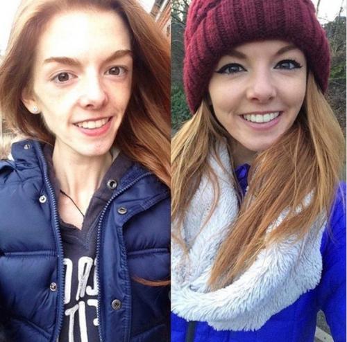 Эта прекрасная девушка смогла победить страшную анорексию и встретила свою любовь. 01