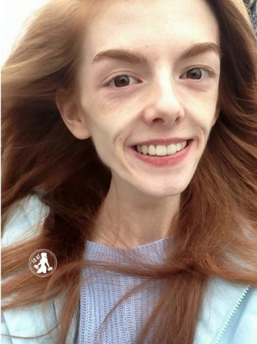 Эта прекрасная девушка смогла победить страшную анорексию и встретила свою любовь.