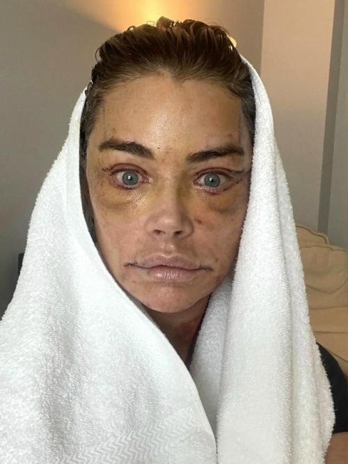 55-Летняя актриса Дениз Ричардс, секс - символ 90-х, смогла вернуть свою молодость и естественную красоту. 02