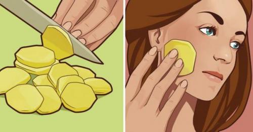 Она лицо кусочком сырого картофеля каждый день на ночь натирала.  