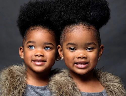 Близняшки - африканочки с голубыми глазами. 01
