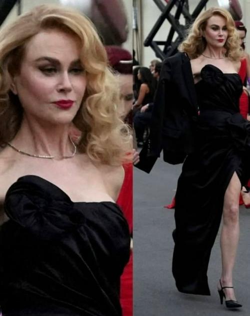 Николь кидман - красавица, но она слишком часто использует филлеры! 
