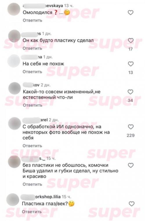 Павла прилучного заподозрили в пластике на новых фото. 03