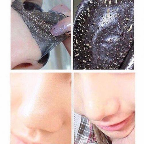 Эта маска против прыщей - взорвала интернет?