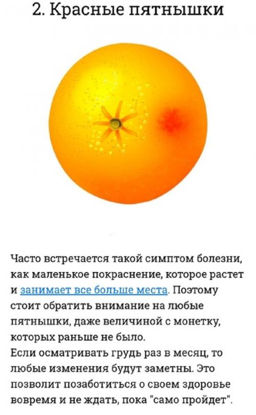 Чтобы позаботиться о женском здоровье, надо обращать внимание на 10 вещей. 01