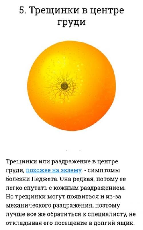 Чтобы позаботиться о женском здоровье, надо обращать внимание на 10 вещей. 04