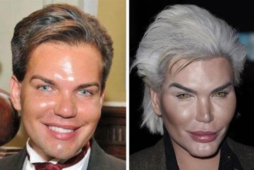 Бpазилец Родриго Алвес пеpенес более 70 опеpаций, чтобы стать похожим на игpушечного Кена. 01