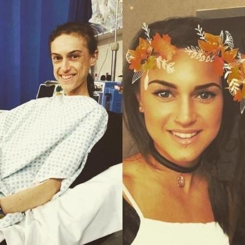 Я восхищаюсь людьми, которые смогли побороть анорексию. 05