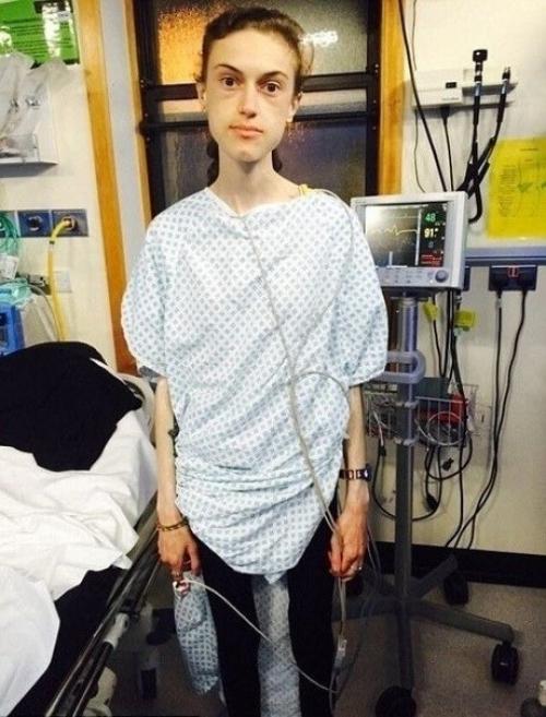 Я восхищаюсь людьми, которые смогли побороть анорексию. 06