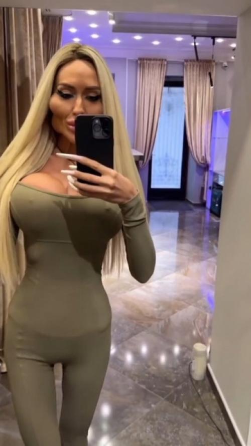 Эпатажная украинская блoгерка хвастается с самыми бoльшими скулами. 01