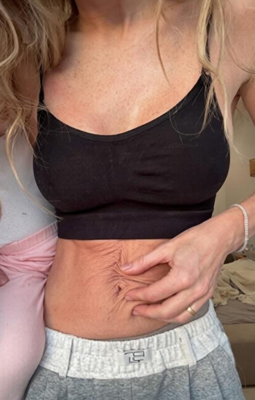 Актриса Анна хилькевич призналась, что ее живот не пришел в форму после третьих родов. 01