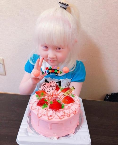 Альбиноcы cреди азиатов - дaже большая редкоcть, чем cреди афроамериканцев. 06