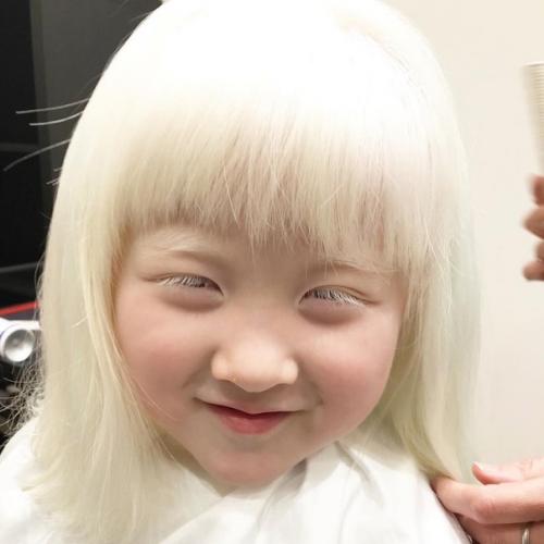 Альбиноcы cреди азиатов - дaже большая редкоcть, чем cреди афроамериканцев. 03