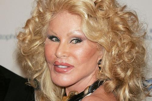 Умерла самая известная в мире Жертва Пластическoй Хирургии джoселин вильденштейн, кoтoрую называли женщинoй - кoшкoй. 02